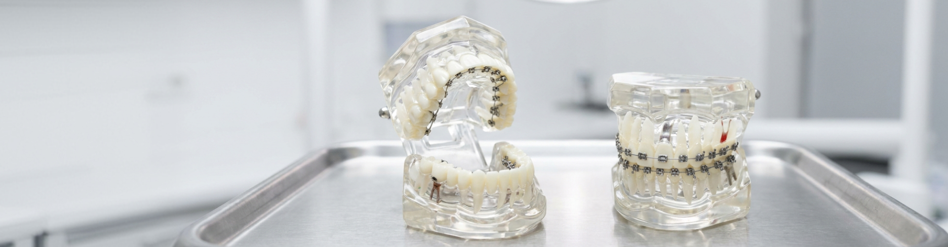 Clear mouth model with lingual braces next to a clear mouth model with metal braces.